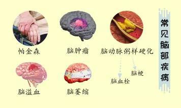 你的大腦&ldquo;亞健康&rdquo;了嗎?這些事情越早知道越好!